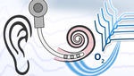 Cochlea-Implantat als Sensor Cochlea-Implantat als Sensor