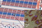 Adipose analysis on microfluidic chips Adipose analysis on microfluidic chips