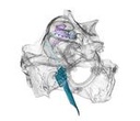 Lighting matrix in the ear: First use of multi-channel cochlear implants with microscale light-emitting diodes Lighting matrix in the ear: First use of multi-channel cochlear implants with microscale light-emitting diodes