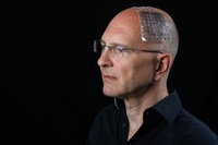 Neuralink und die Zukunft der Neurotechnologie